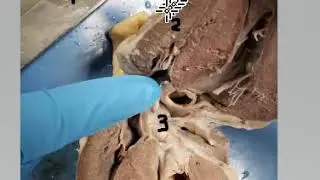 Sheep heart mock practical B 1-3