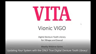 Updating Your System with the ONLY True Digital Denture Tooth Library!