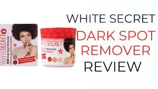 White Secret Dark Spot Remover Cream Review &mdash; Watch Before You Buy/Use | #productreview #whitesecret