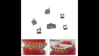 AZDENT 10 Packs Dental Orthodontic Brackets Passive Self Ligating Braces MBTRoth 0 022 345 Hook