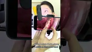 Dental macro photography with iPhone - photo fill light for dentistry - MK017