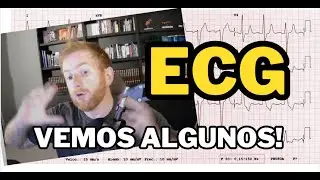 Practicamos ECG juntos