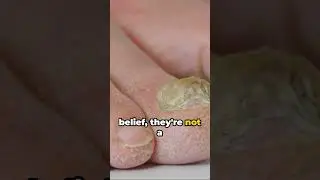 Nail it: Unveiling Human Nail Facts #new #shortsviral #factsofthings-uk #nails #human