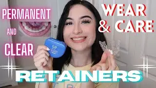 Braces: Retainers // Clear & Permanent + close-ups
