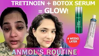 Tretinoin + Dr Sheth&rsquo;s Botox Serum = Age-Reversing Glow? | My Honest Review & Routine 💖