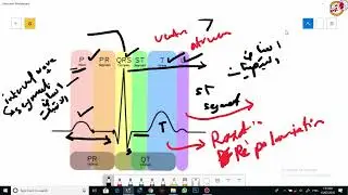 ECG مراجعه مبسطه وشامله لاهم مواضيع  تخطيط القلب لطلاب المراحل الاولى طب عام اوتمريض