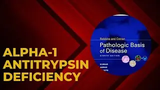 Alpha 1 antitrypsin deficiency | Pathogenesis | Emphysema formation | Morphology | Clinical features