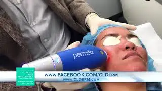 Dr. Wu Discusses Clear + Brilliant Laser on San Diego Connect
