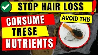 7 Essential Nutrients That Prevent Hair Loss You Never Knew Can Help