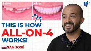 All on 4 Dental Implants in San Jos&eacute;, Costa Rica: Patient&rsquo;s Case Study & Expert Insights