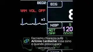 Facciamo chiarezza sulle aritmie cardiache: cosa sono e quando preoccuparsi