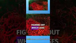 Understanding Clinically Significant Prostate Cancer #shorts