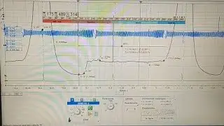 Шевроле Авео не заводится, оживляем после других, мотор-тестер рулит!