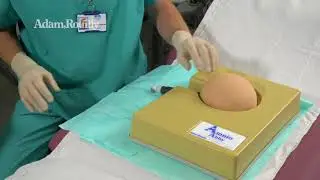 Amniocentesis CVS - Amnio Abby