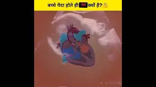 बच्चे पैदा होते ही रोते क्यों है?🤔  #shorts #youtubeshorts #ytshorts