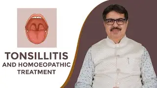 TONSILLITIS AND HOMOEOPATHIC TREATMENT | EXP. BY DR. KEDARNATH A. LONGANI (M.D) HOM LONGANI CLINICS