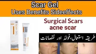 Scar gel Uses in Urdu l How to Use Scar Gel 