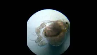 Microscopic view of Daphnia or water flea