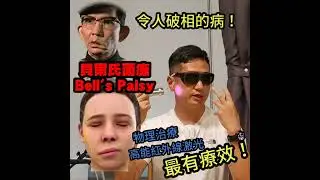 剖析 Bell's Palsy貝爾氏面癱 / 一種可怕令人破相的疾病 / 最新高能量遠紅外線刺激神經生長治療