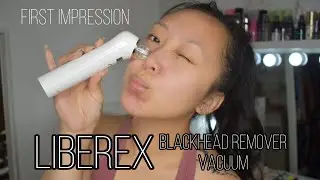 LIBEREX Blackhead Remover First Impression/Review