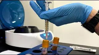 PLATELET RICH FIBRIN FOR HAND REJUVENATION