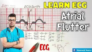 راجع معلوماتك بموضوع رجفان الأذيني للقلب Atrial Flutter