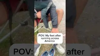 Which set of feet are worse? #running #hyrox #fitness #athlete #feet