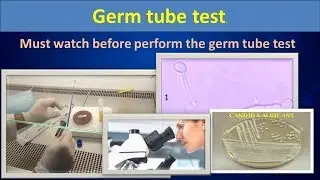 Germ tube test.(simply describe procedure).