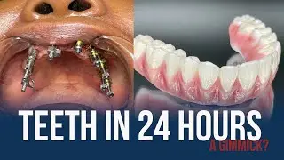 Must Watch! TEETH IN 24 HOURS is a gimmick!