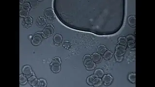L-form Bacteria/Mold Bio-film