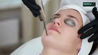Detox & Radiance Boost: Glutathione Injections in Los Angeles