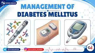 14. Management of Diabetes Mellitus 💊  USMLE Step 2 CK | Internal Medicine High-Yield Review