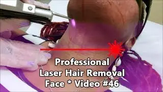 Professional Laser Hair Removal * Face * Video 🎥 #46