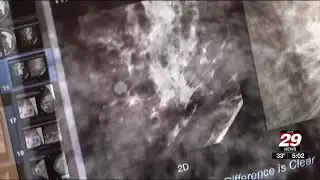 Virginia law to require insurance coverage for breast cancer screenings starting Jan. 1