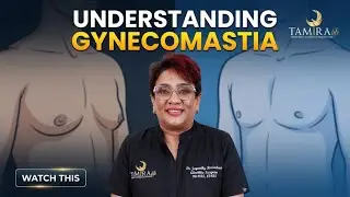 Understanding Gynecomastia…! | Tamira Life | Chennai