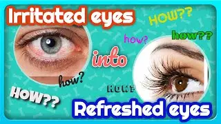 Refresh Tears Lubricant Eye Drops Multi-pack 4 bottles + 1