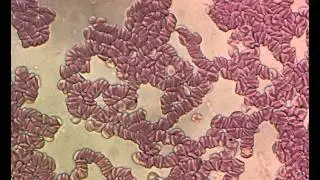Human Blood: Fibrin mesh