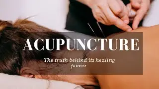 Acupuncture Exposed, the truth behind its healing power