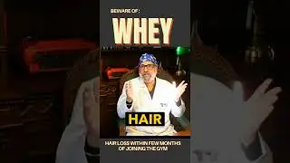 Beware of Whey Protein if you have male pattern baldness!