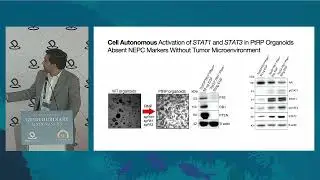 Tinengotinib (TT-00420), a JAK1 and FGFR1-3 inhibitor, to reverse plasticity for PC- Dr. Samir Zaidi