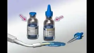 how you can detect Tooth Caries