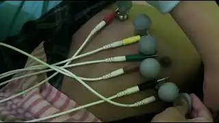 PEMERIKASAAN EKG (ELEKTROKARDIOGRAM)