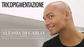 TRICOPIGMENTAZIONE - una soluzione rapida per calvizie, diradamento o alopecia