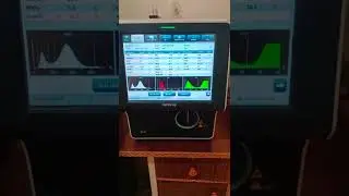 BEST HEMATOLOGY ANALYZER - MINDRAY BC-30 FULLY AUTOMATIC