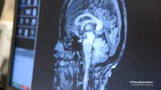 Clinical Excellence in the Department of Neurological Surgery at UT Southwestern