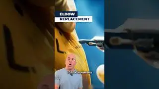 See How Doctors Fix a Broken Elbow With Metal Parts!