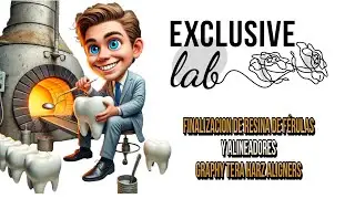 Finalización de Resina de Férulas y Alineadores | Graphy Tera Harz Aligners en Exclusive Lab