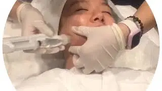 Skin Booster at ISA Beauty Top Ryde