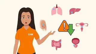Поделитесь способами снижения конкретных рисков развития рака | Модуль 3: Содействие профилактике...