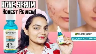 Garnier Fast Clear Serum for Acne Prone Skin | Honest Review |